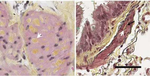 Figure 4. ECM fraction in the ASM layer. The smooth muscle layer of central (left panel)  and peripheral airways (right panel) contains ECM proteins