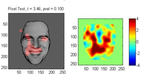 Figure 13 : Image de classification obtenue pour les 4 enfants avec au développement typique par le test des pixels et  notes Z pour l’expression de joie