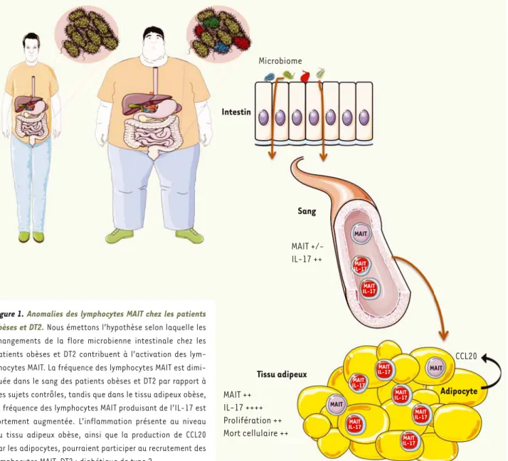 Figure 1. Anomalies des lymphocytes MAIT chez les patients  obèses et DT2. Nous émettons l’hypothèse selon laquelle les  changements de la flore microbienne intestinale chez les  patients obèses et DT2 contribuent à l’activation des  lym-phocytes MAIT