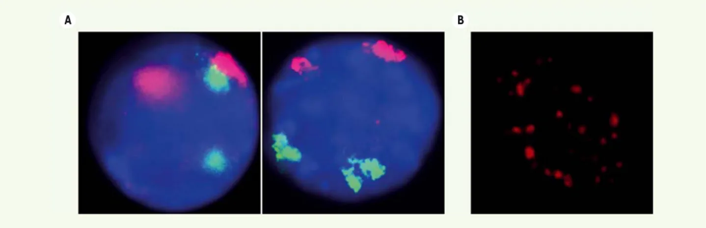 Figure 1. Le noyau des cellules eucaryotes en interphase est compartimentalisé. A. Noyaux de cellules érythroïdes (panneau de gauche) et de rein  fœtal (panneau de droite) de souris colorés au DAPI (4’,6’-diamidino-2-phénylindole) (bleu), dans lesquels les