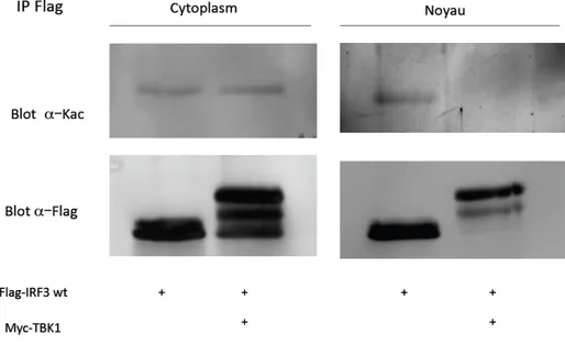 Figure 11: Acétylation d’IRF3 dans le cytoplasme et le noyau.   