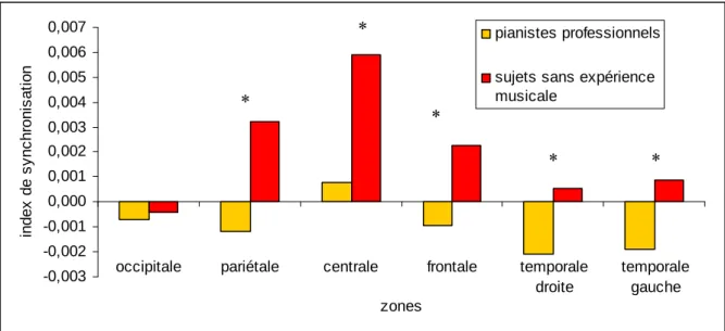 Figure  6.  Valeurs  de  l’IS  dans  la  bande  de  fréquence  20-30  Hz  lors  de  la  condition  de  reproduction pour les sujets sans expérience musicale et les pianistes professionnels