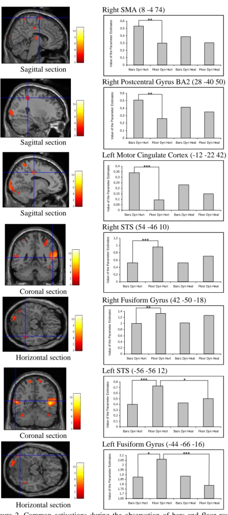 Figure  2.  Common  activations  during  the  observation  of  bars  and  floor  routines  irrespective  of  the 
