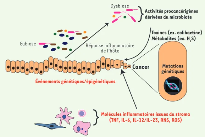 Figure 2. Changements du microbiote induits par l’inflammation qui facilitent l’émergence d’une  tumeur.