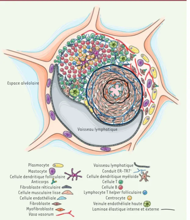 Figure 1. Néogenèse lymphoïde dans les lésions vascu- vascu-laires pulmonaires de patients avec HTAP idiopathique