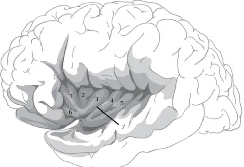 Figure 1. Illustration du lobe insulaire et de ses principales subdivisions anatomiques : 1 : gyrus  court antérieur ; 2 : gyrus court moyen ; 3 : gyrus court postérieur ; 4 : gyrus long antérieur ; 5 :  gyrus long postérieur ; 6 : gyrus accessoire ; 7 : s