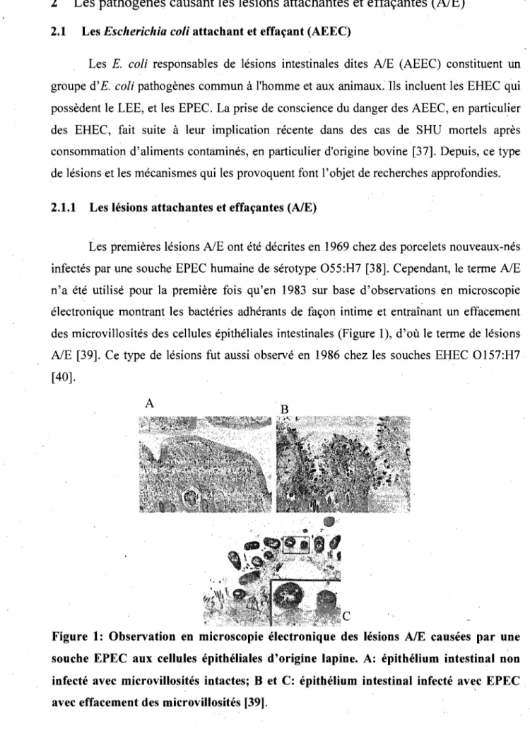 Figure  1:  Observation  en  microscopie  électronique  des  lésions  AIE  causées  par  une  souche  EPEC  aux  cellules  épithéliales  d'origine  lapine