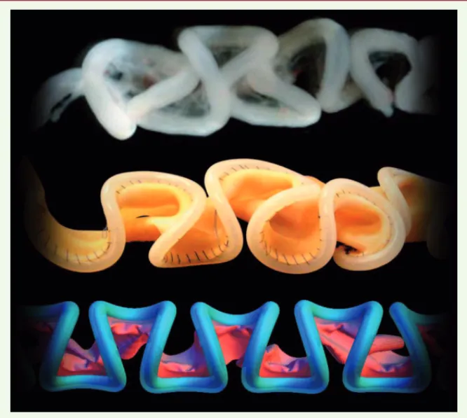 Figure 2. Les différentes étapes de la modé- modé-lisation de l’enroulement intestinal