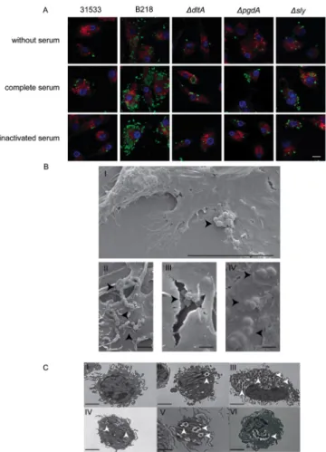 Figure  2.  (A)  Confocal  microscopy  showing  internalization  of  S.  suis.  BmDCs  were  incubated  with  the  wild-type  strain  31533,  the  non-encapsulated  mutant  B218,  the  ΔdltA  strain, the  ΔpgdA strain or the Δsly strain, not opsonized (top