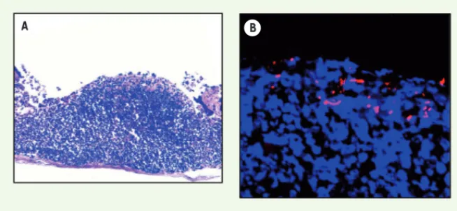 Figure 2. Interaction des bactéries AIEC avec une plaque de Peyer. A. Visualisation d’une plaque  de Peyer murine après coloration à l’hématoxyline-éosine