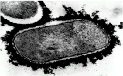Figure 1. Image par microscopie électronique d’A. pleuropneumoniae sérotype 1 et de sa capsule  marquée à la ferritine polycationique (Rioux, Galarneau et al