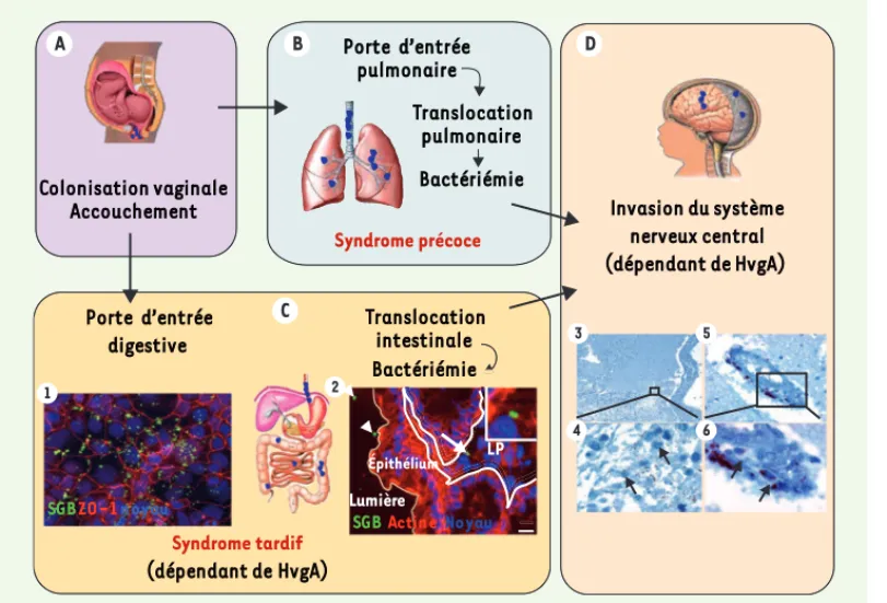 Figure 1.  Scénario physio- physio-pathologique de l’infection  néonatale à streptocoque du  groupe B