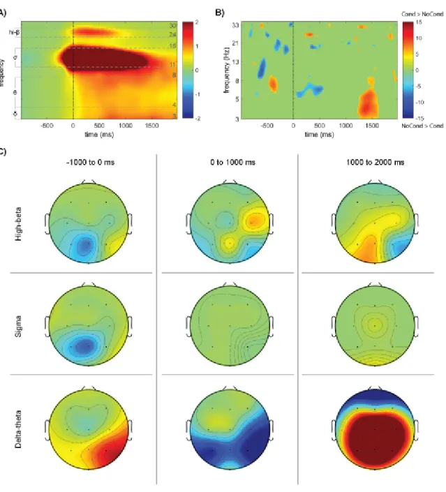 Figure 3. Stimulation-dependant sleep spindle time-frequency decomposition. 