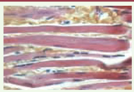 Tableau I. Caractérisation des cellules SSEA-1+ issues de la différenciation de CSEh. FLK1 : fetal  liver kinase, autre nom du VGEFR23, récepteur du VEGF (vascular endothelial growth factor) ;  TBX : T box ; VG : ventricule gauche ; MESP : mésoderme postér