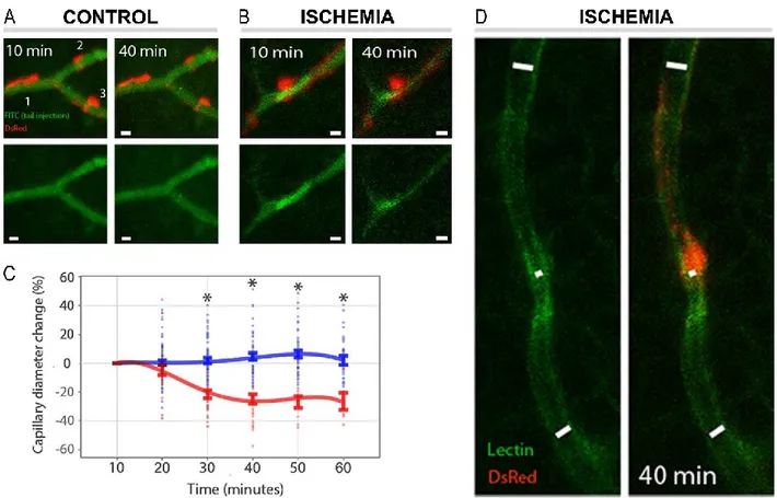 Figure  9.  (A-B)  In  vivo  monitoring  of  DsRed  retinal  pericytes  along  the  capillaries  after  intravenous  tail  injection of FITC-dextran-70S (green) shows a constricting pericyte leading to reduced capillary diameter  during  ischemia  (B)
