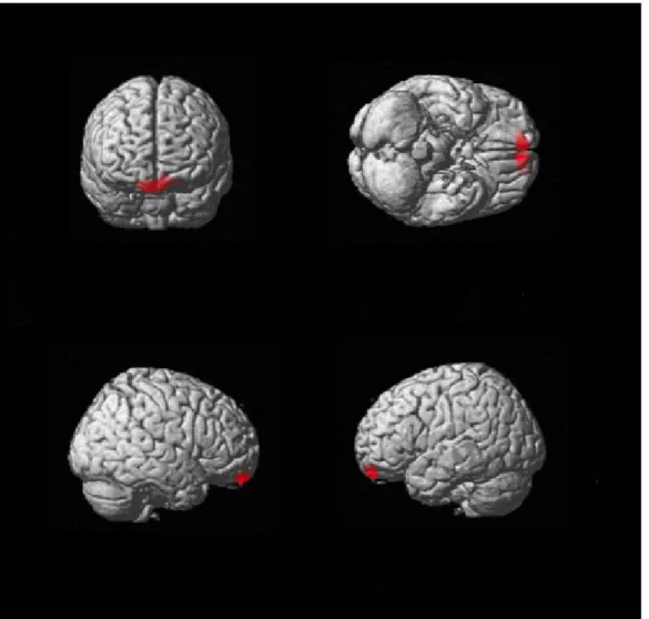 Figure 5. Correlational analysis between the rs-fcMRI strength of the left aHip and the bilateral  ventromedial frontal cortex and semantic performance (Boston Naming Test, Pyramid and Palm Tree  Test and Similarities Subtest of the WAIS III, p&lt;0.05 FDR