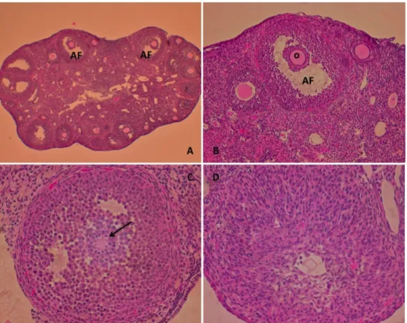 Figure  5  –  HE  staining  of  Cyp19Cre-cKO  ovaries  in  6-month-old  females.  A)  Whole  ovary  (100x);  B)  Antral  follicle  lacking  cumulus  expansion  (200x);  C)  Entrapped  oocyte  (400x);  D)  Luteal-like  structure  (400x); (AF) Antral follicl