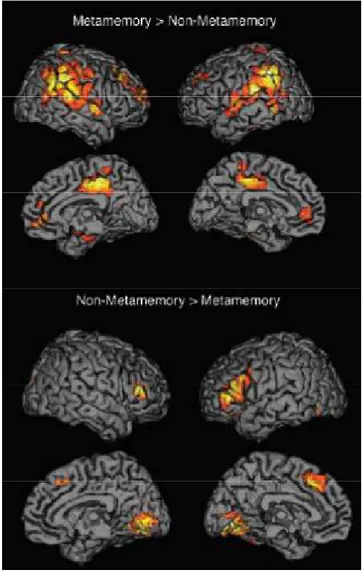 Figure 8. IRMf issue de l'étude de Chua et al. (2009) montrant les différentes activations  cérébrales en fonction de la tâche effectuée (tâche de métamémoire vs tâche contrôle)