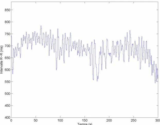 Figure 5 : Représentation des variations de l’intervalle R-R (données brutes issues de nos  données expérimentales) 