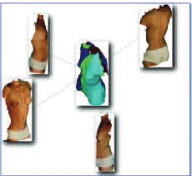 Fig. 2. Merging the four polygonal surfaces.