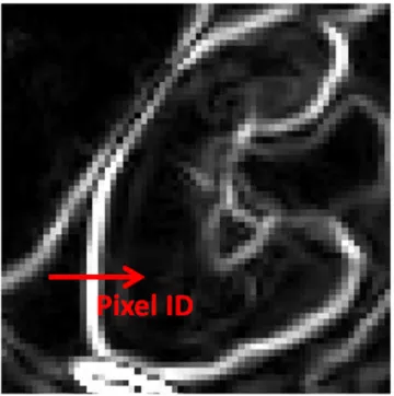 Figure 2.5 – Gradient de l’image d’une coupe abdominale : zoom sur le rein droit.