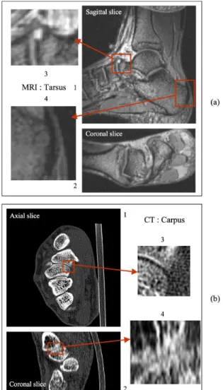 Fig.  1.  Data  examples  obtained in  vivo:  MRI  (0.5x0.5x1.5mm)  of  the  tarsus  [1] (a) and CT (0.3x0.3x1mm) of the carpus (b)