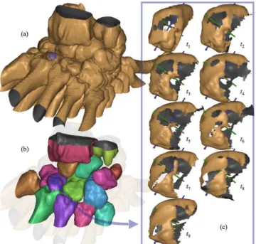 Fig.  3.  Difficulties  encountered  while  addressing  the  kinematics  of  carpus  bone  components  from  in  vivo  CT  segmentations