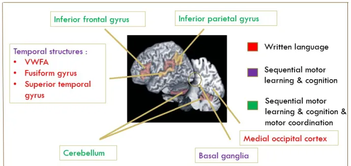 Figure 1. Dyslexia: neural correlates  