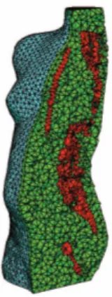 Fig. 1. Lateral cut of the tetrahedral patient trunk model