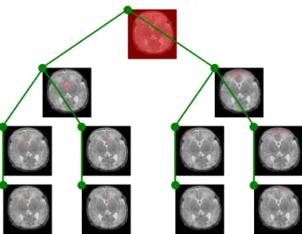 Figure 3. Partial max-tree representation of the image given in Fig- Fig-ure 1(a). Each node (i.e., green circle) of the tree represents a connected component (i.e., red region) in the upper level sets X λ ; note that only a very small subset of nodes of t
