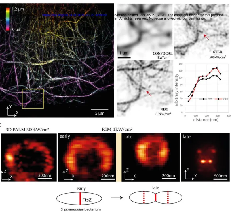 Figure 2: RIM allows high-fidelity super-resolved live imaging in the three dimensions