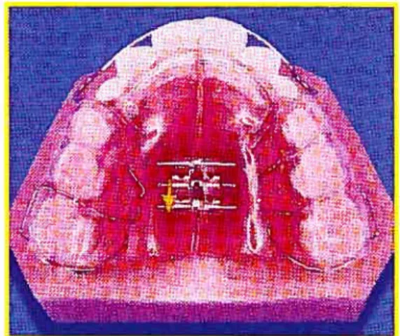 Figure 2: Appareil de Schwarz