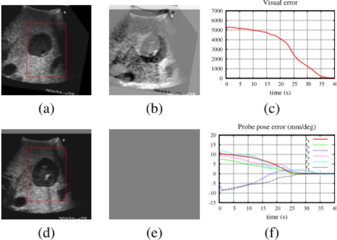 Fig. 1. Positioning task using visual features extracted from a single US image. The visual convergence from the initial US view (a) to the final one (d) is shown by the corresponding difference image with the desired view (respectively (b) and (e))