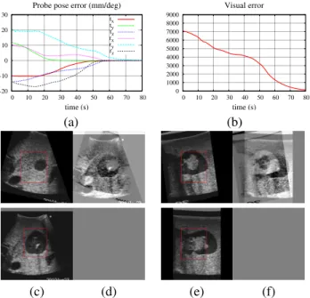 Fig. 6. Experimental setup. A six dof anthropomorphic robotic system (a) is equipped with a force sensor and a bi-plane or 2D US probe which provides images of a realistic abdominal phantom (b).