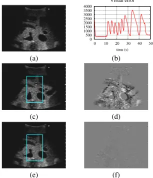 Fig. 8. Positioning task with the bi-plane probe. The visual convergence (f) from the initial US views (a) and (b) to the final ones (c) and (d) is shown by the corresponding images difference with the desired views