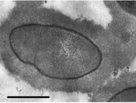 Fig. 1. Transmission electron microphotograph of thin sections of S. suis serotype 2 reference  strain S735, which shows a thick capsule characteristic of this serotype