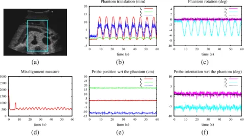 Fig. 4. Tracking of an abdominal cross section (a) while the phantom undergoes a periodic exter- exter-nal motion applied at t = 6s in translation (b) and rotation (c)