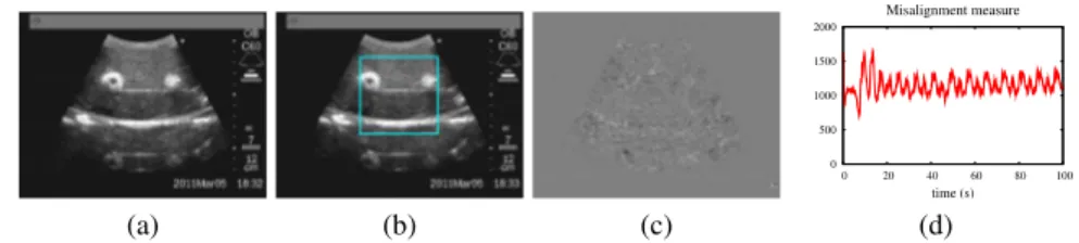 Fig. 5. Tracking results with the deformable phantom of an US slice containing two tumors.