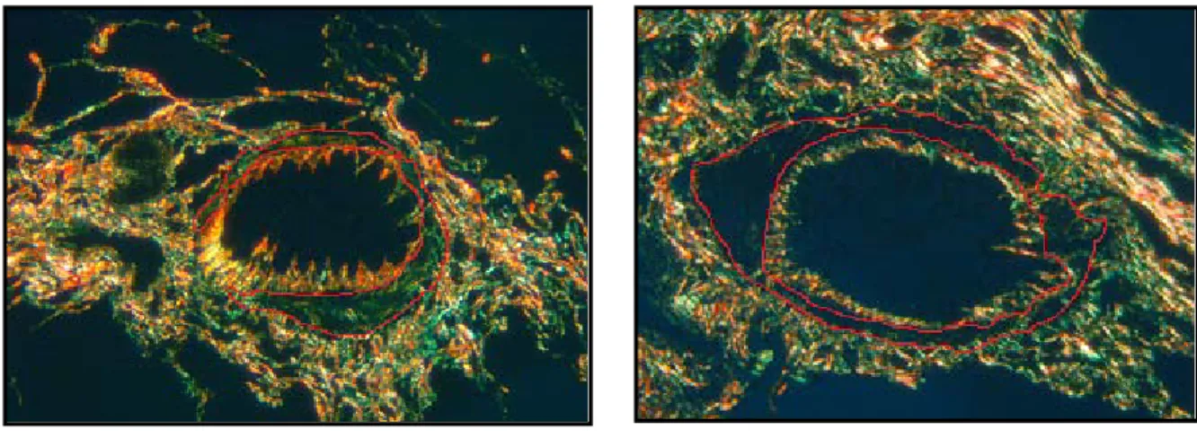 Figure  11  Picrosirius-red stained airways under polarized light were divided into two  categories based on presence or absence of collagen fibers in the airway smooth muscle