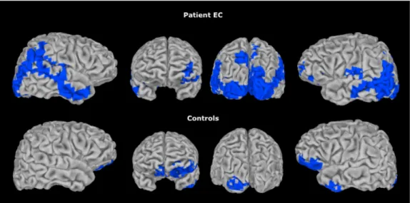 Figure 4.  Patterns of mean functional activation for EC and the Control group 