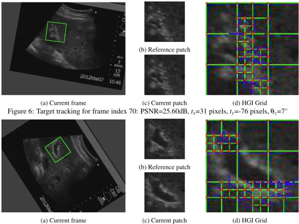 Figure 7: Target tracking for frame index 108: PSNR=26.46dB, t x =-29 pixels, t y =-80 pixels, θ z =−55 ◦