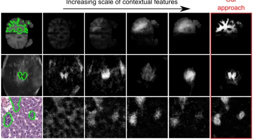 Fig. 1: How to choose the right scale when extracting visual context? This figure illustrates the motivation of this work