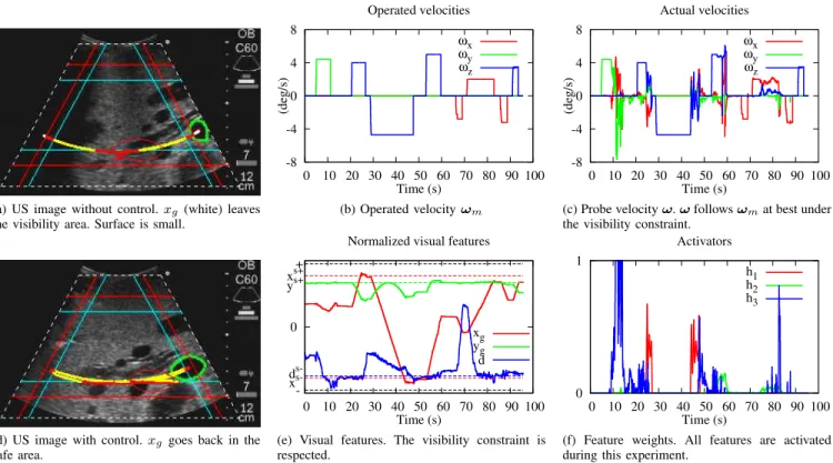 Fig. 7. Results on the real phantom. US image without (a) and with (d) the control law