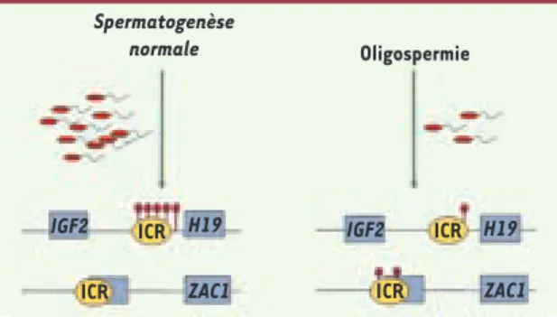 Figure 1.  Oligospermie : patrons de méthylation perturbés au niveau des ICR. 