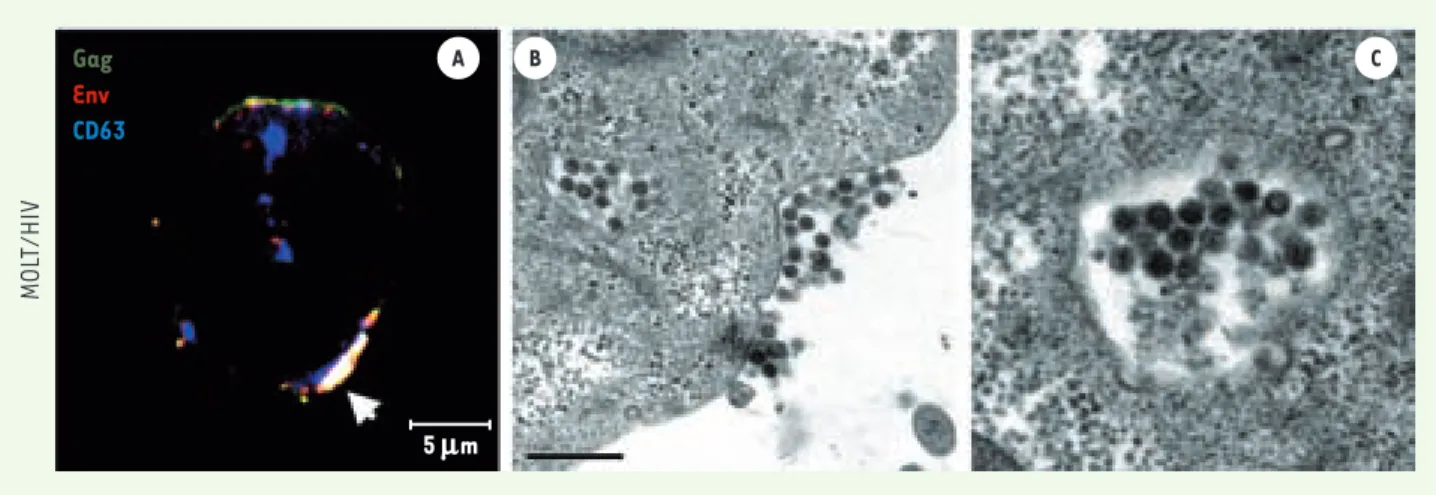 Figure 3. Accumulation des virions VIH-1 dans les endosomes tardifs de cellules lymphoblastiques T chroniquement infectées par VIH-1