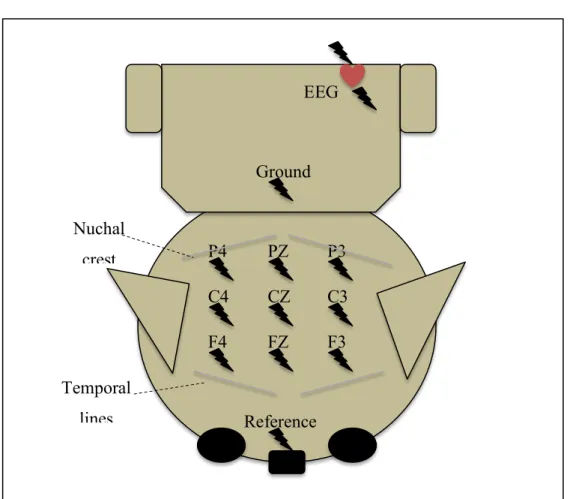 Figure 3.  Montage référentiel EEG 