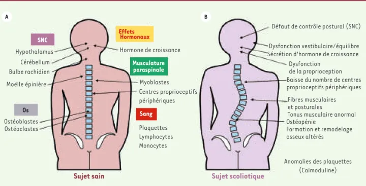 Figure 2. Systèmes ciblés par l’action de la mélatonine et symptômes observés chez les patients scoliotiques