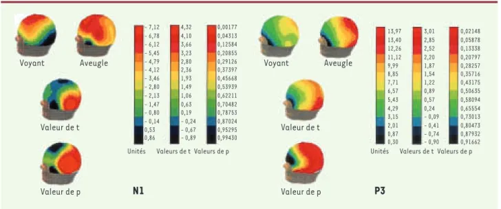 Figure 2. Distribution des composantes N1 (portion gauche de la figure) et P3 (portion droite de la figure) chez les personnes aveugles et voyantes  durant une tâche de localisation sonore