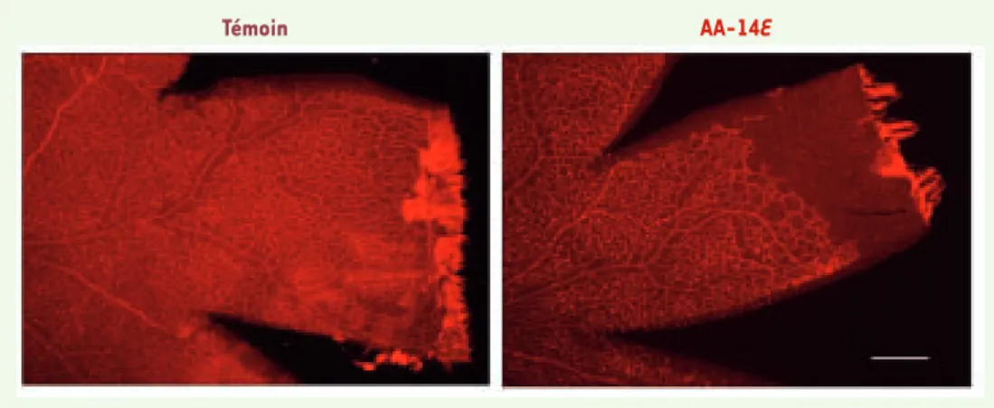 Figure 3.  Effets de l’acide trans-arachidonique sur la vascularisation rétinienne et la densité vasculaire