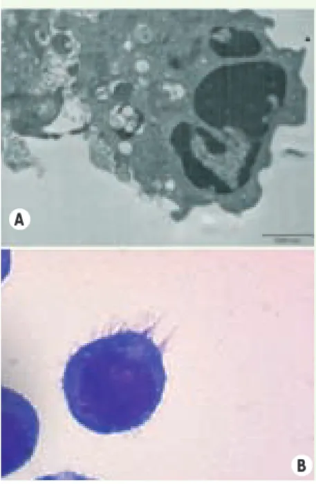 Figure 1.  Morphologie des IKDC.  A. Photo  de  microscopie électronique d’une IKDC de rate  de souris phagocytant des débris cellulaires  après coculture de 24 heures avec des cellules  tumorales B16F10 (réalisée par Graça Raposo,  Institut Curie, Paris, 